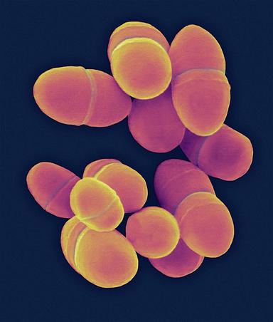 Lactococcus lactis